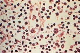 bhopal ,  Laughing virus is more dangerous than corona