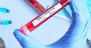 bhopal, Eighth death ,corona, Madhya Pradesh, two people died 