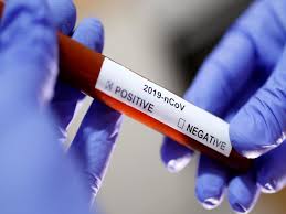 bhopal, While treating corona, health department , 29 reported positive