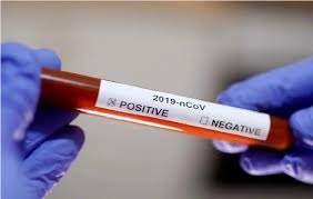 bhopal, Zee news, two dozen media workers, Corona positive!