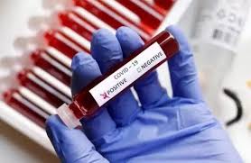 bhopal, Rapidly spreading, infection,  record 149 ,new positives found