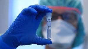 bhopal, Corona: Epidemic after a hundred years