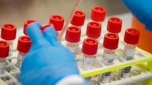 bhopal, Corona virus: claims to be made in China