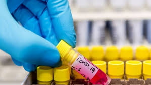 bhopal, Kovid,example , negligence, capital of the country