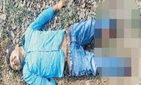 jabalpur,  Both the legs, young man 