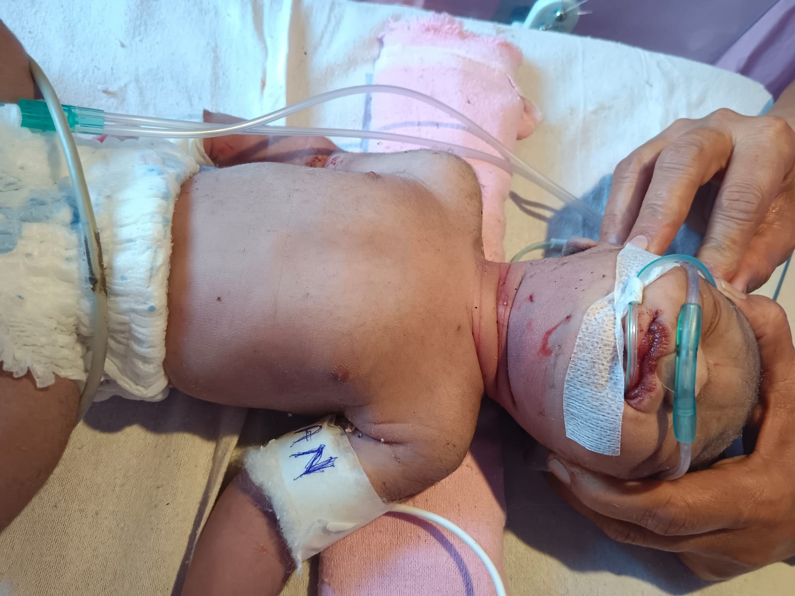  जिला अस्पताल में लावारिस मिली नवजात बच्ची