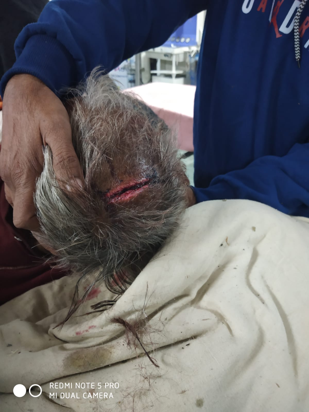 रसूखदारों ने किया बुज़ुर्ग पर कुल्हाड़ी से वार