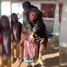 गैंग्रीन पीड़ित पिता के लिए भटक रही बेटी