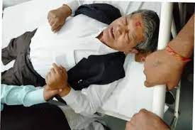 हरीश रावत सड़क दुर्घटना में घायल