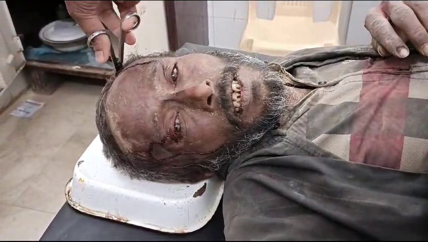 8 लोगों ने मिलकर युवक पर किया हमला