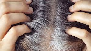 bhopal, growing problem , gray hair  